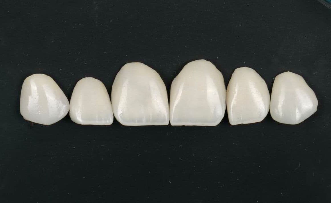Zirconia Crown Set